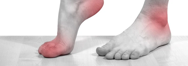 Image showing red areas on foot and ankle to represent pain