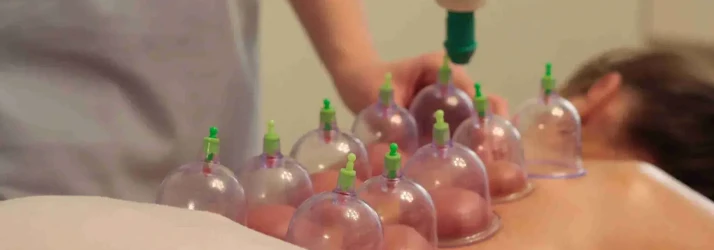 Multiple transparent suction cups with green valves are placed along a person’s back while a hand operates a pump device.